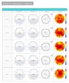 TP-Link EAP772 Omada BE9300 Ceiling AP Tri-Band Wi-Fi 7 574 Mbps 2,4 GHz + 2880 Mbps 5 GHz + 5760 Mbps 6 GHz 1x 2,5 GLAN thumbnail (6 of 8)